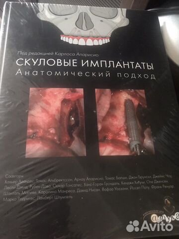 Скуловые имплантантаты анатомический подход книга Скуловые имплантантаты анатомический подход книга