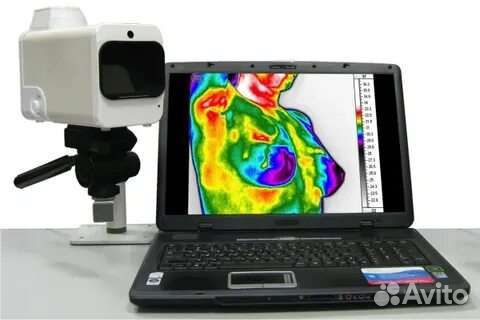 Тепловизор/Термограф иртис 2000 ме